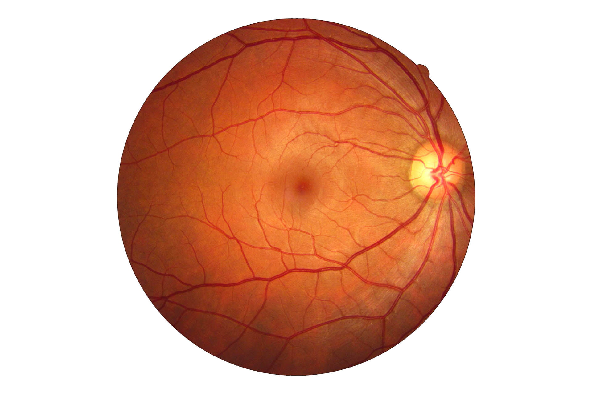 Retina Nedir?