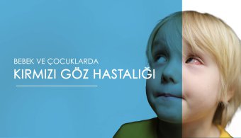 Bebek ve Çocuklarda Kırmızı Göz Hastalığı