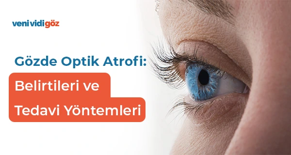 Gözde Optik Atrofi: Belirtileri, Nedenleri ve Tedavi Yöntemleri