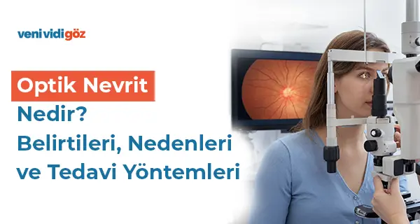 Optik Nevrit Nedir? Belirtileri, Nedenleri ve Tedavi Yöntemleri