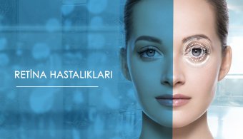 Retina Hastalıkları