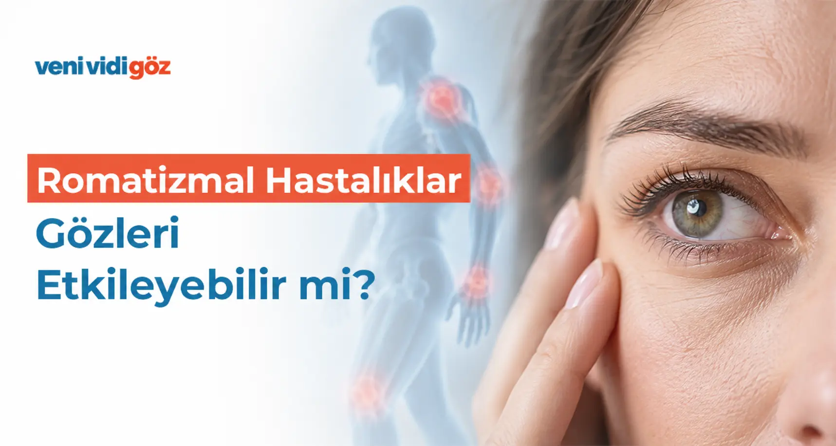 Romatizmal Hastalıklar Gözleri Etkileyebilir mi?