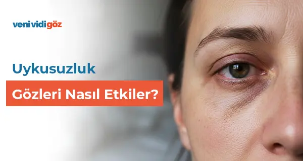 Uykusuzluk Gözleri Nasıl Etkiler?