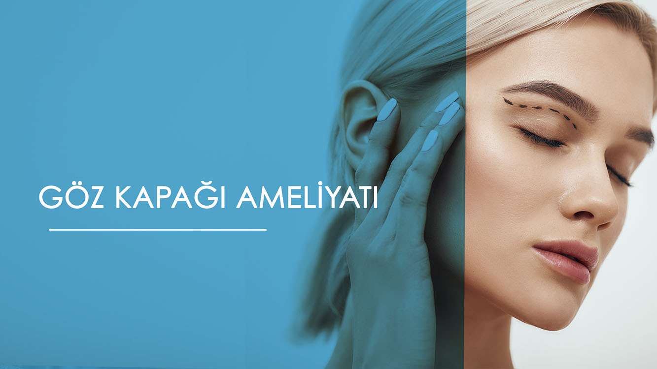 göz kapağaı ameliyatı nedir